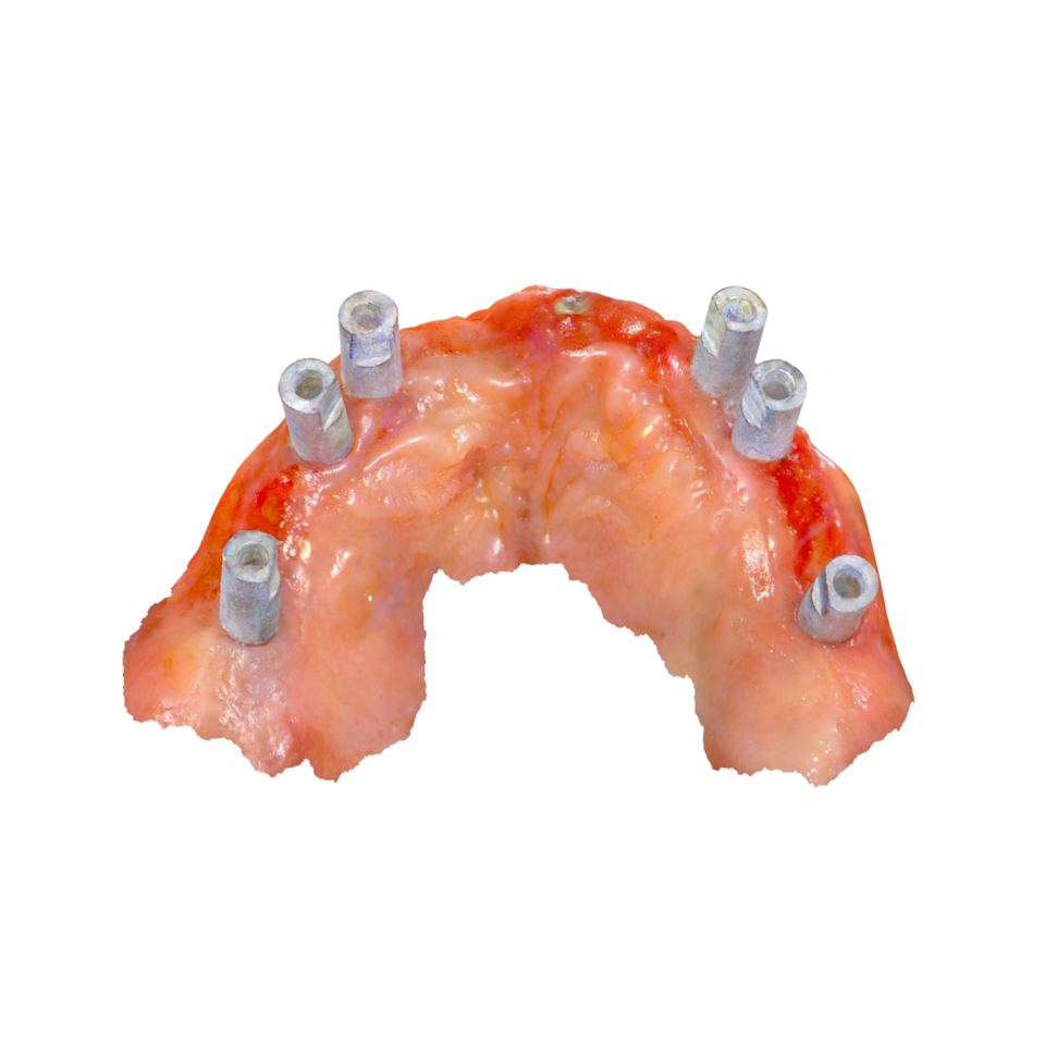 Hi10 Intraoral Scanner detail