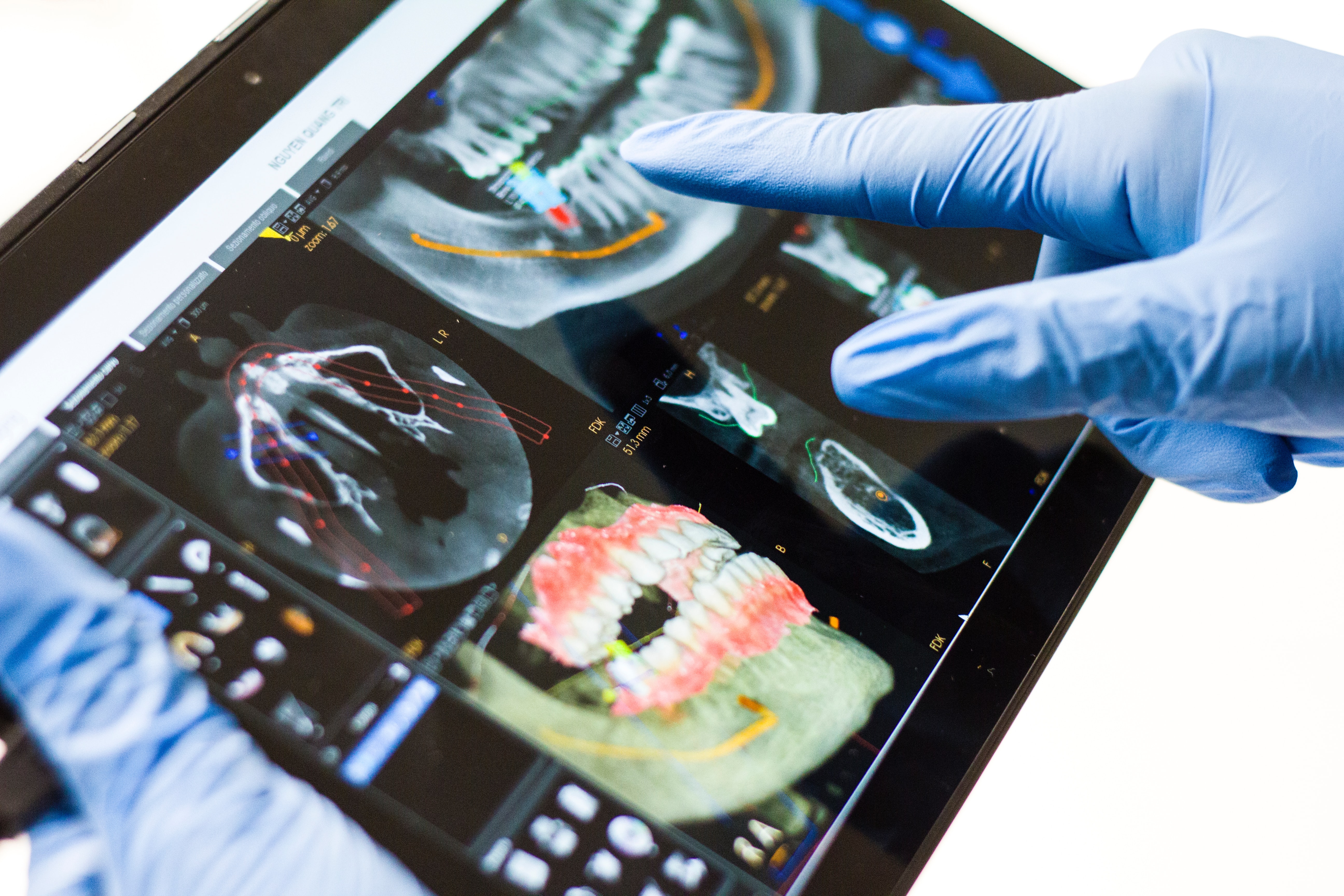 CBCT