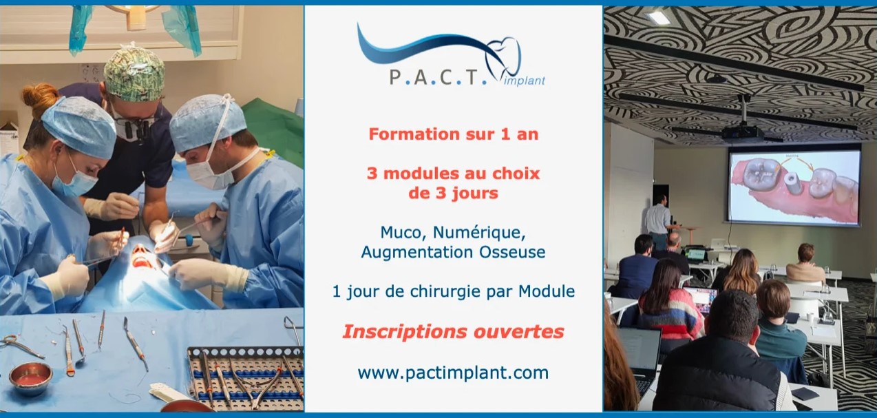 PactImplant formation par modules