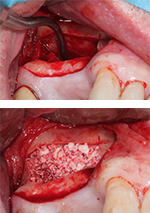 Sinus 1
