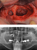 Sinus 2