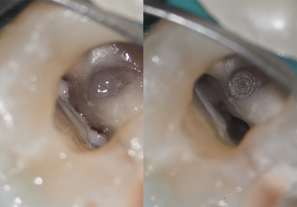 Endodontie