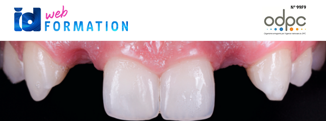 Id Webformation