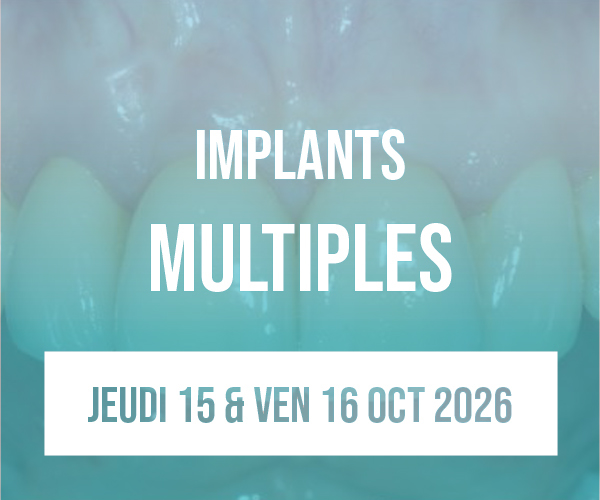Implants multiples