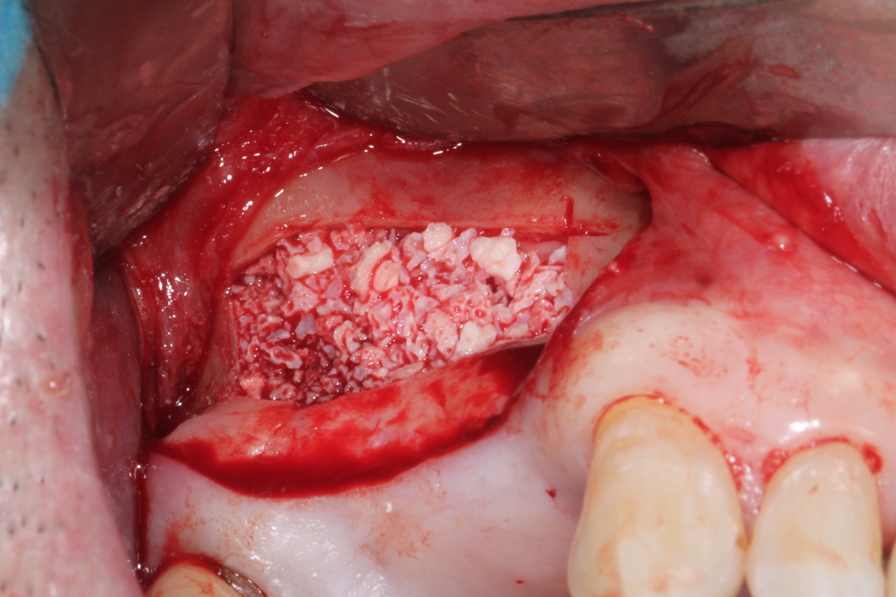 CERAIO - Promotion 2025