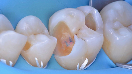la dent vivante - Clinic-All